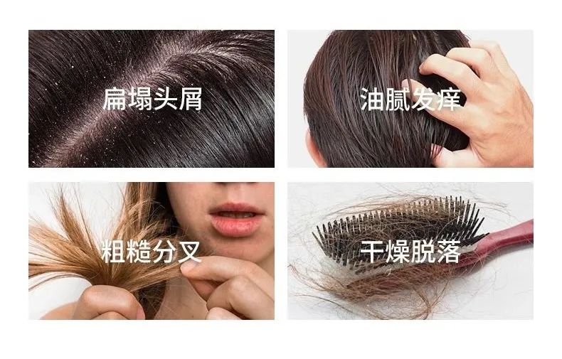 和螨虫说拜拜!持续断货的澳洲茶树洗护系列全新升级!抢先体验(图5)