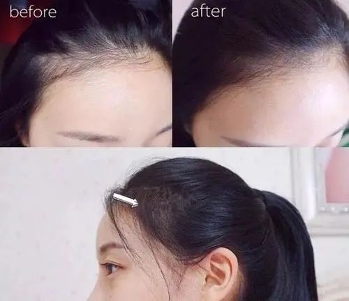 亚麻籽究竟有多神奇?用它,头发蓬松不出油,关键是拯救秃头!(图19)