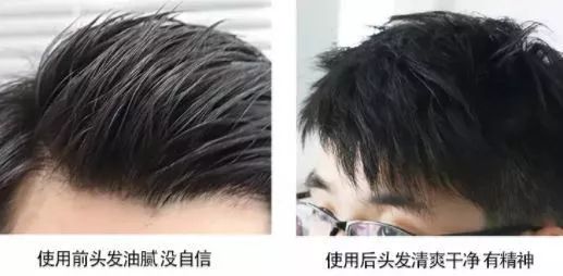 亚麻籽究竟有多神奇?用它,头发蓬松不出油,关键是拯救秃头!(图12)