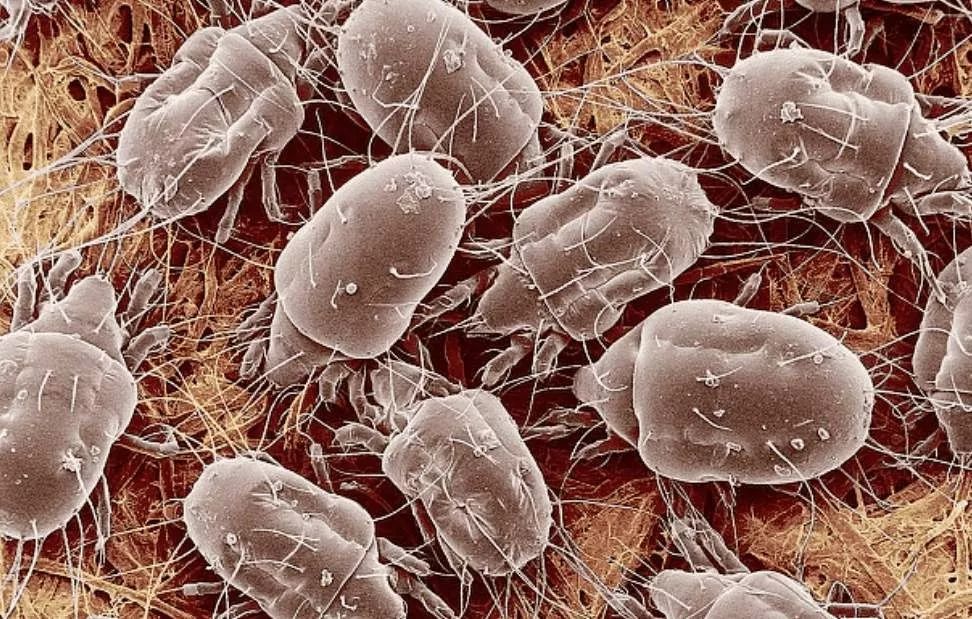 螨虫一除,再回婴儿肌,痘痘不是顽疾!(图6)