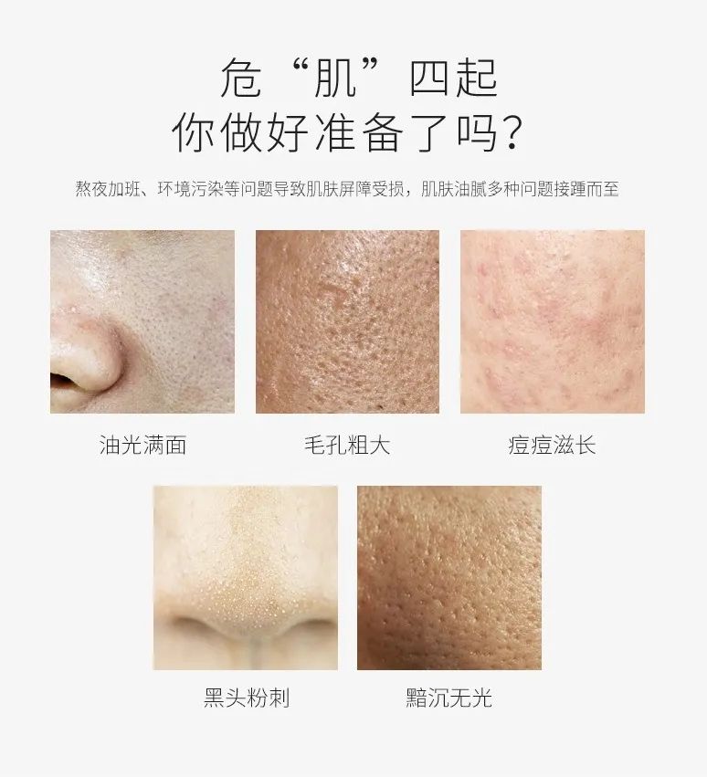 植树®|澳洲茶树精油祛痘控油套盒 油痘星人的种草来咯~(图1)