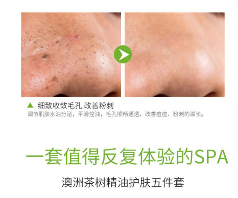 植树®|澳洲茶树精油祛痘控油套盒 油痘星人的种草来咯~(图5)