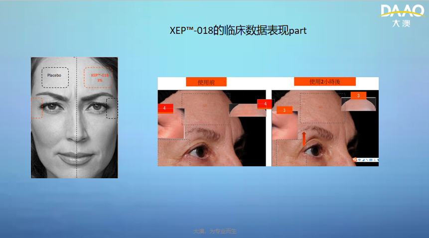 特证美白祛斑霜,跟“斑”说拜拜(图7)