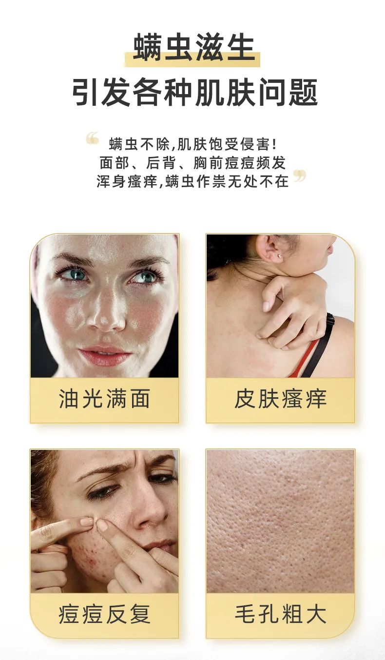 芝士除螨皂,痘痘螨虫克星(图1) 图片