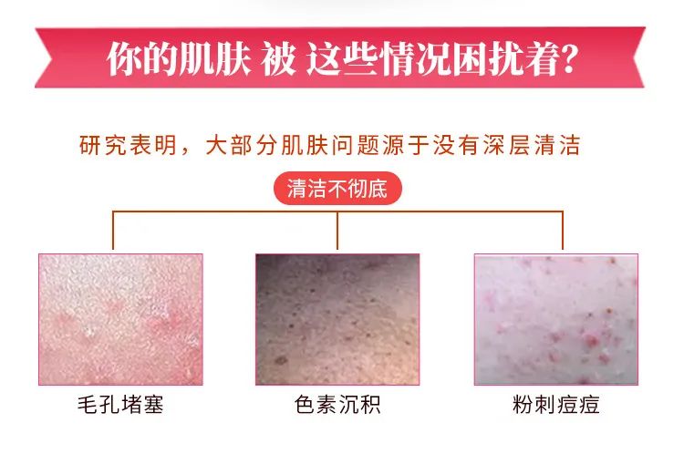 曲酸皂_03.jpg 图片