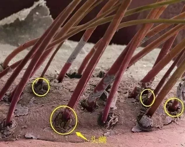 澳洲茶树精油洗发水,除螨、去油、味道芳香(图5) 图片