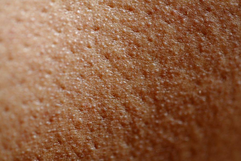 就是让你白、让你嫩、让你仙!!!一白遮千丑!神仙原液烟酰胺!(图4) 图片